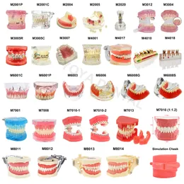 Diğer Oral Hijyen Çoklu Türler Diş Modeli Diş Diş Öğretim Modelleri Çalışma Ortodontik Çıkarılabilir Diş İmplant Modelleri Diş Hekimi Malzemesi 230524