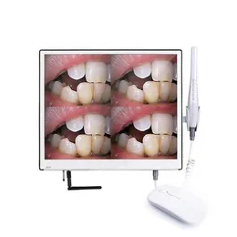 Tutucu kol braketi ile monitör /diş kamerası ile dental 17 inç wifi monitör intraoral kamera