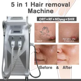 MACCHINA LASER YAG switch laser per capelli rimozioni di tatuaggio 2 maniglie certificazione CE Equipaggiamento di bellezza