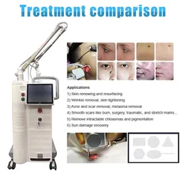 Laser 4D Foton Fractional Treatment Gravur Netzteil 10600 nm Schönheitsmaschine zur Hauterneuerung von Aknenarben