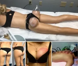 Kompaktowe urządzenie do rzeźbienia na urządzenie próżniowe układu rozszerzania piersi z CUPPING, Scraping and Heat Therapy do masażu, ulepszenia i podnoszenia pośladków