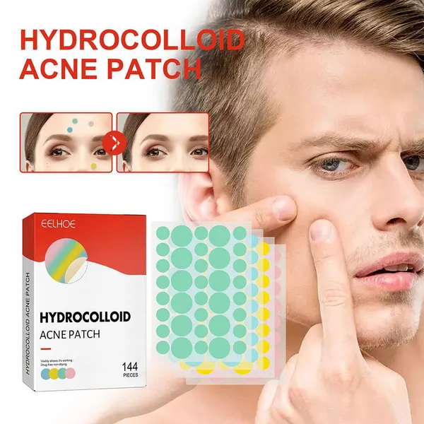 Facial Acne Remover Pimple Patch Face Skin Care Freckle Pimple 144pcs Patches Beauty Health Treatment Beauty Scar Acne Mask L9S0