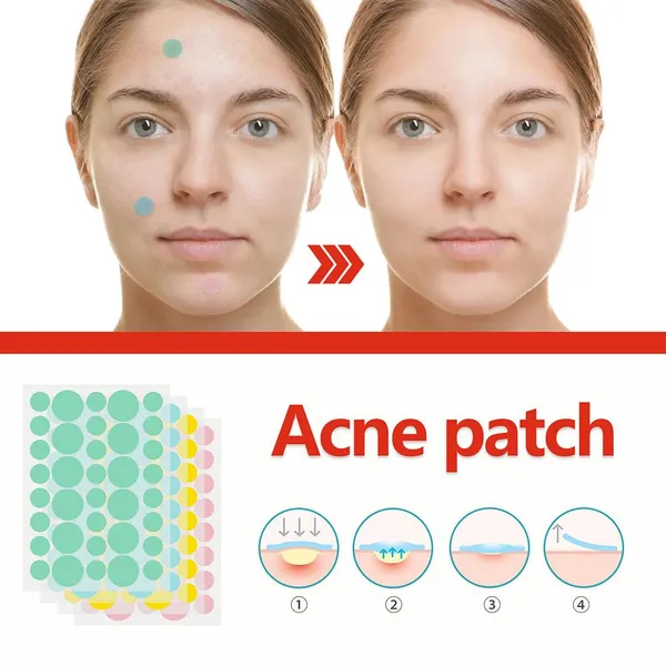 Facial Acne Remover Pimple Patch Face Skin Care Freckle Scar Treatment 144pcs Health Mask Patches Beauty Pimple Beauty Acne L1P3