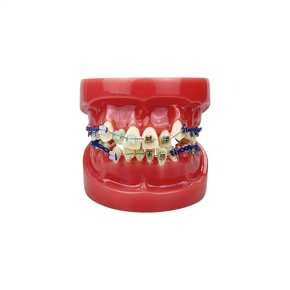 Orthodontic Dental Treatment Teeth Model Teaching Study Gum Tooth ...