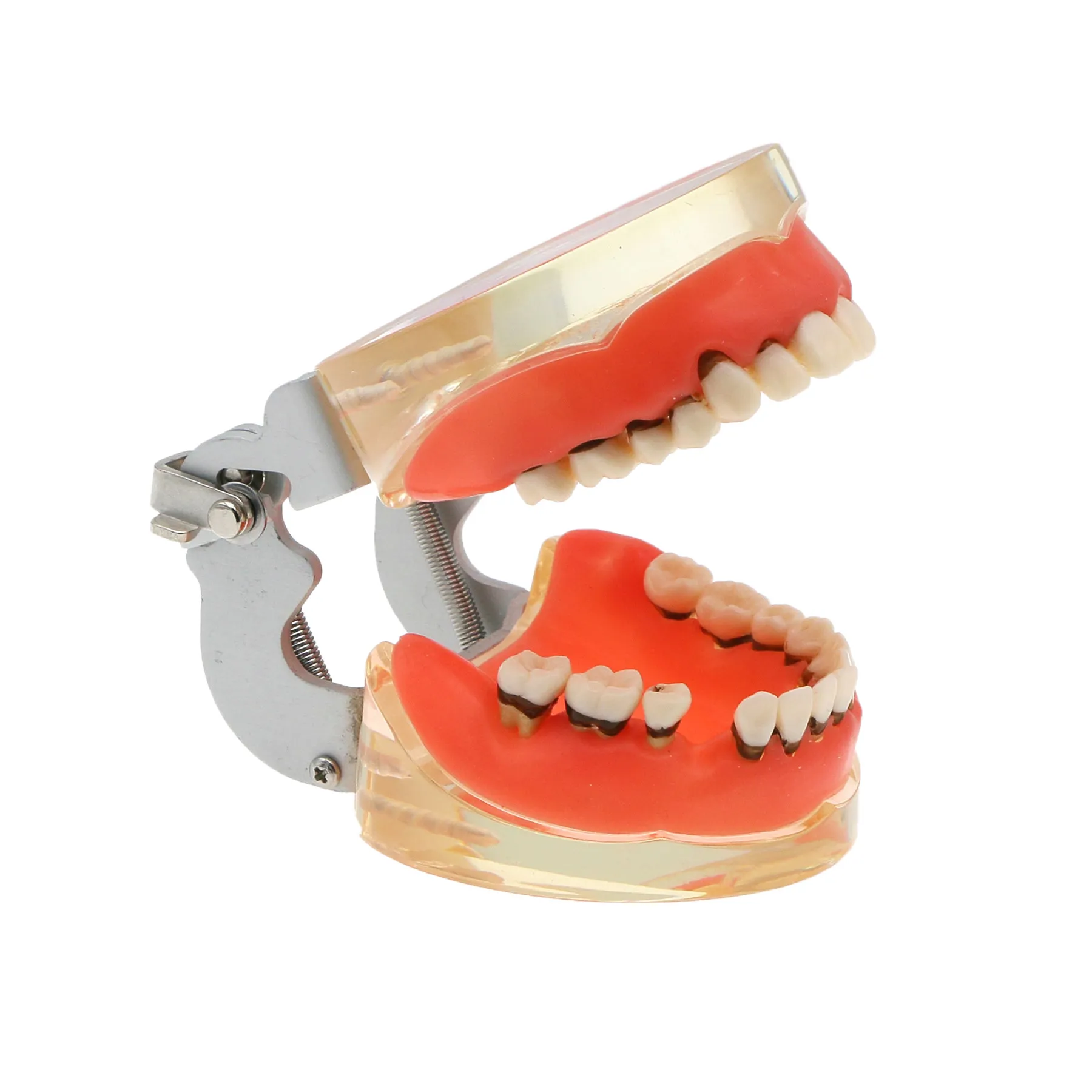 Modèle Dentaire Typodont Implant All On 4 - Mâchoire Supérieure Et Inférieure Amovible - Neuf