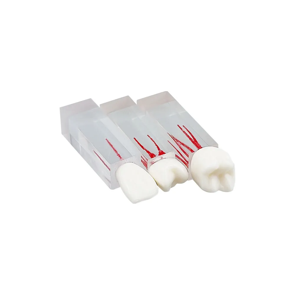 Dental Teeth Model Endodontic Root Canal Block... From Ddmyjan, $64.53 ...