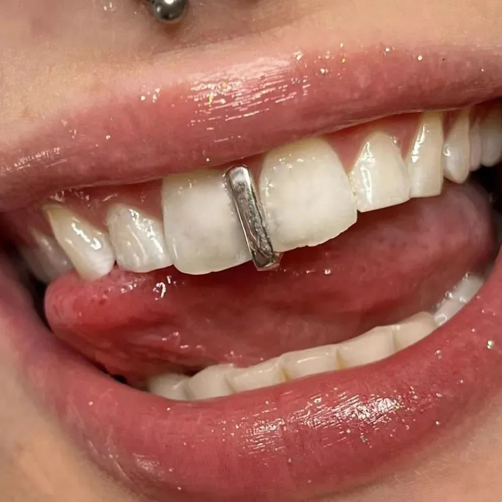 Rose Gold Double Cap Solid K9 Open Face Grillz