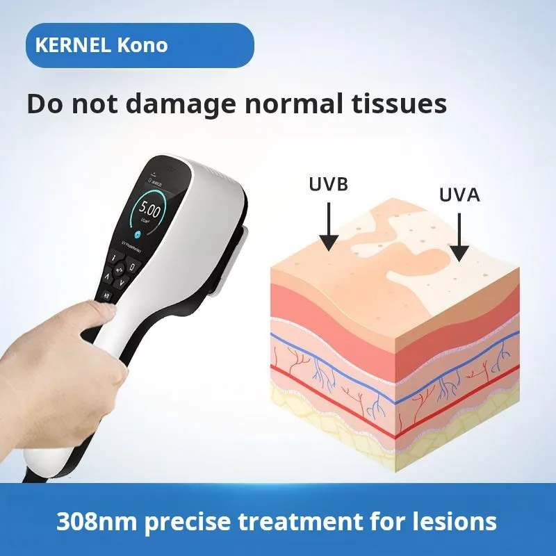 Intensity 37+-5000C Kono excimer 308 medical non laser therapy ...