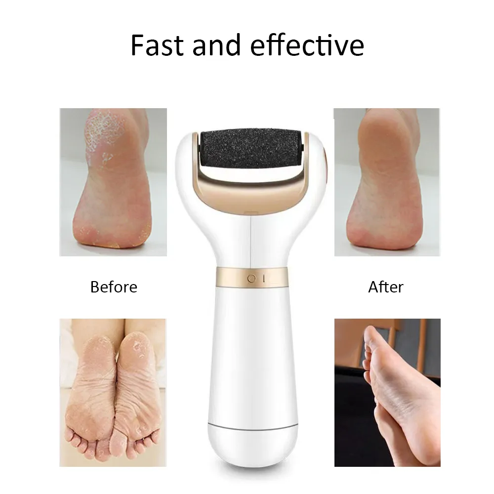 Ponceuse Pour Pieds - Retonnement Et Lissage De La Peau, Outil De Soin Des Pieds